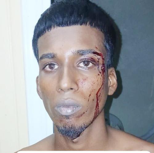 One of the bandits nabbed by police, Renardo Persaud