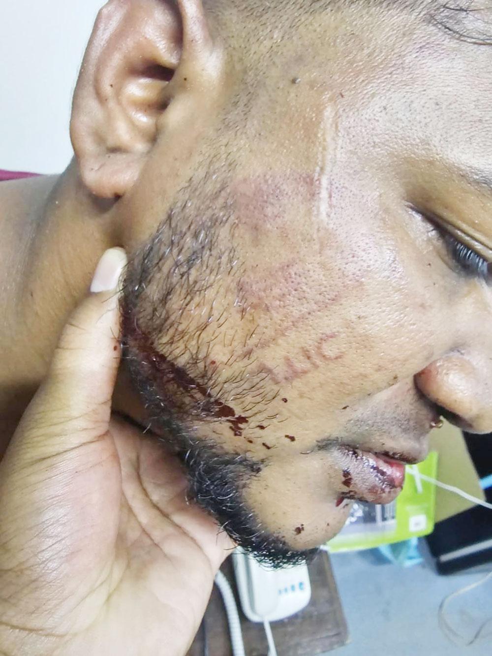 Brain Persaud; injuries received to his face